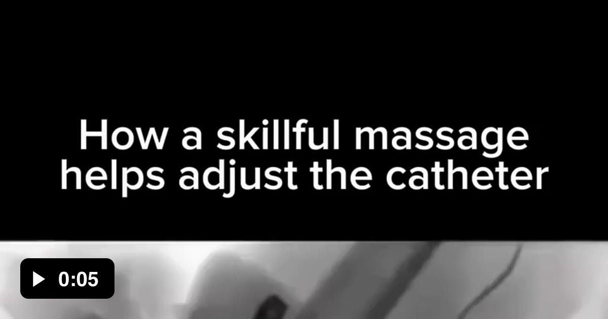 Skillful Massage Technique Helps Align Catheter in Angiographic Exam