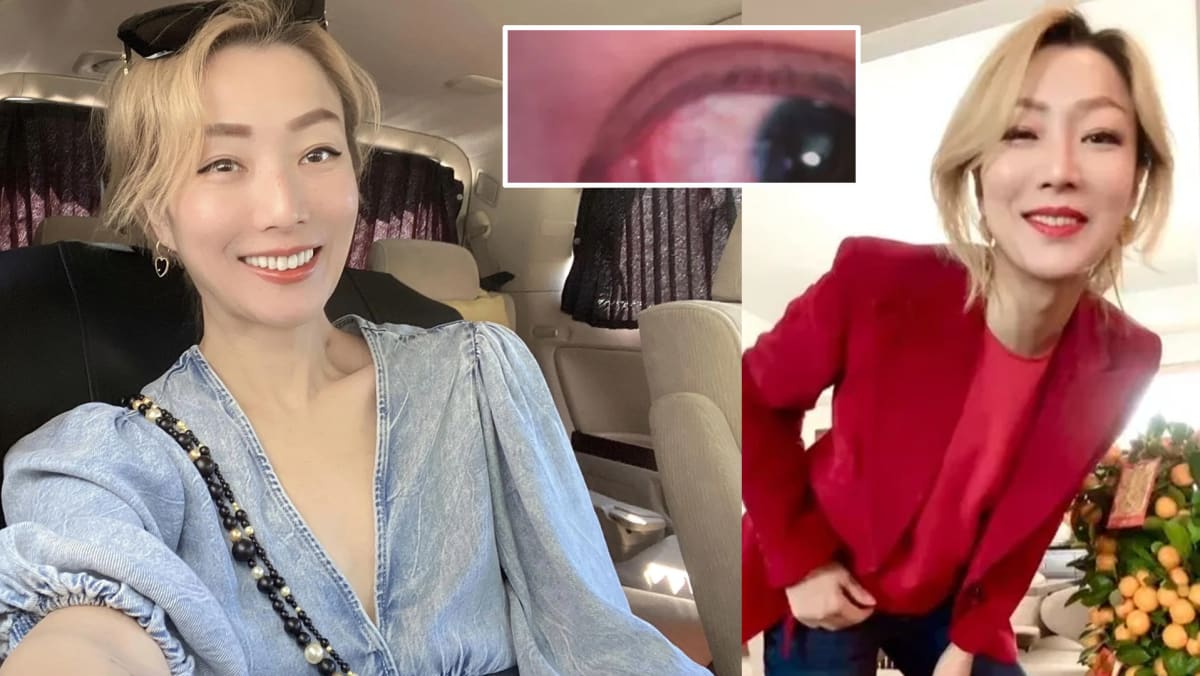 Sammi Cheng Accidentally Uses Silicone Bra Cleaner As Make-Up Remover, Eyes Turn Bloodshot