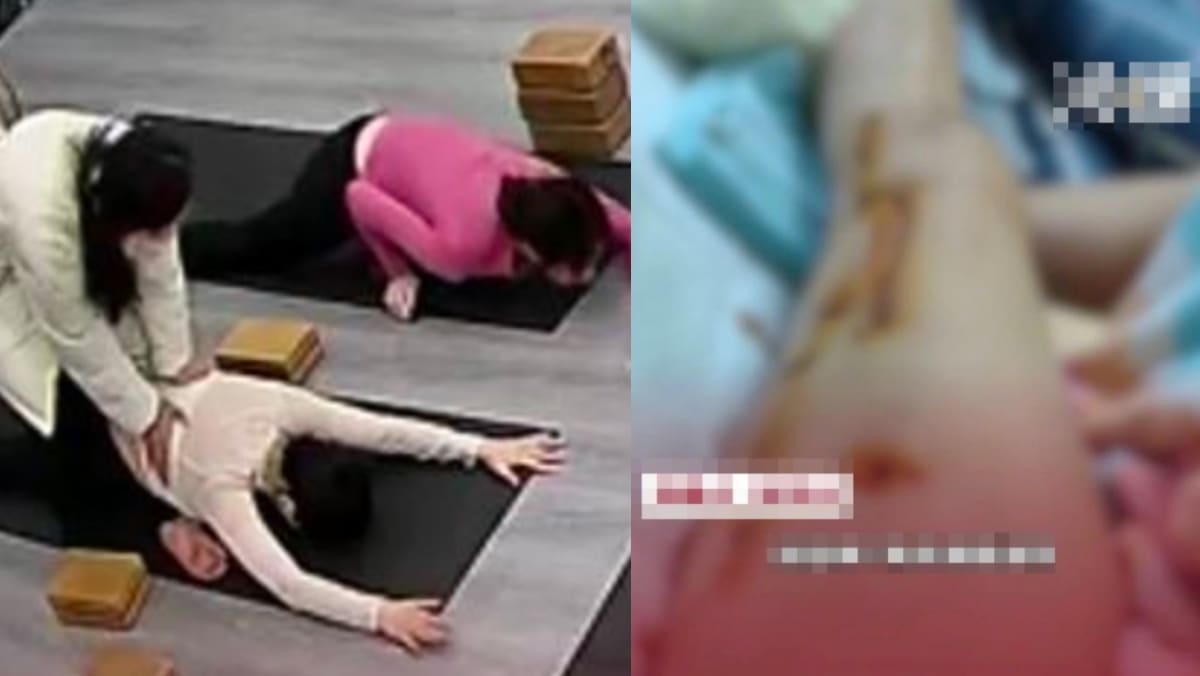 Chinese Woman Breaks Leg During Yoga Lesson After Instructor Pushes Her Into A Too-Deep Stretch