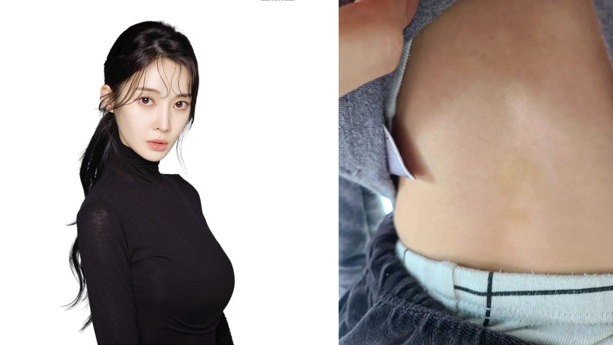 Former T-ARA Member Accuses Ex-Husband Of Peeing On Their Sons & Smearing Their Faces With Poo