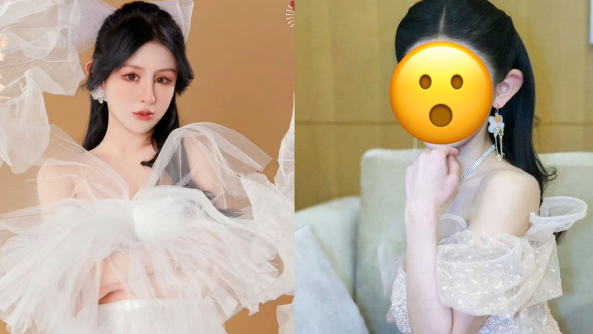 Chinese Influencer, 20, Has Spent More Than S6.5K On Hundreds Of Plastic Surgery Procedures Since She Was 13