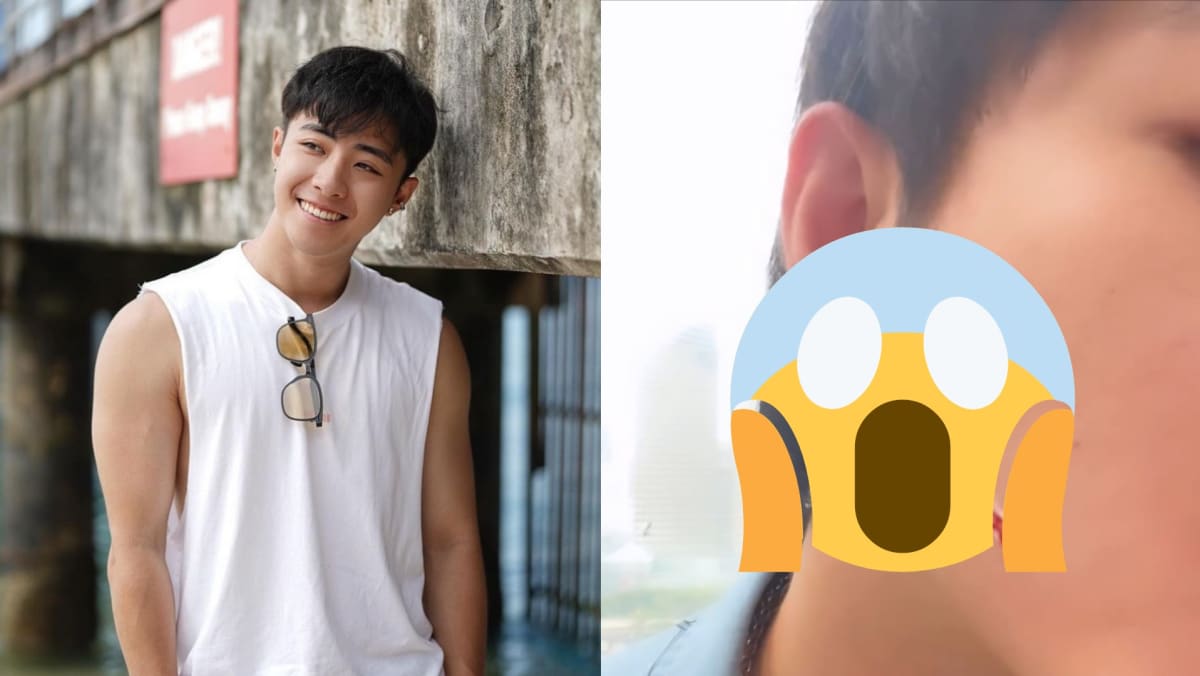 “I Think I Look Quite Badass Now”: Zong Zijie Gets 10cm Cut On His Cheek While Filming New Mediacorp Drama