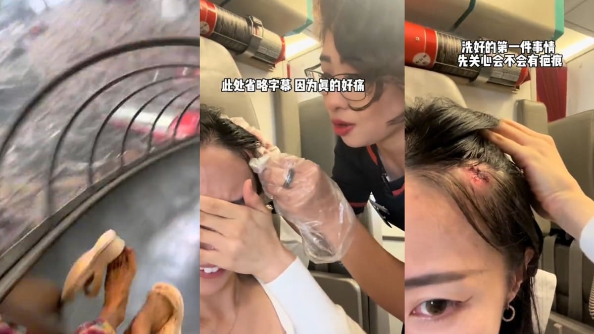 Influencer Injures Head While Going Down Tube Slide At Changi Airport T4