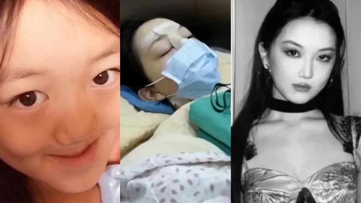 Faye Wong’s Daughter Li Yan, 18, Posts Photo Of Herself Allegedly Undergoing Final Surgery For Her Cleft Lip