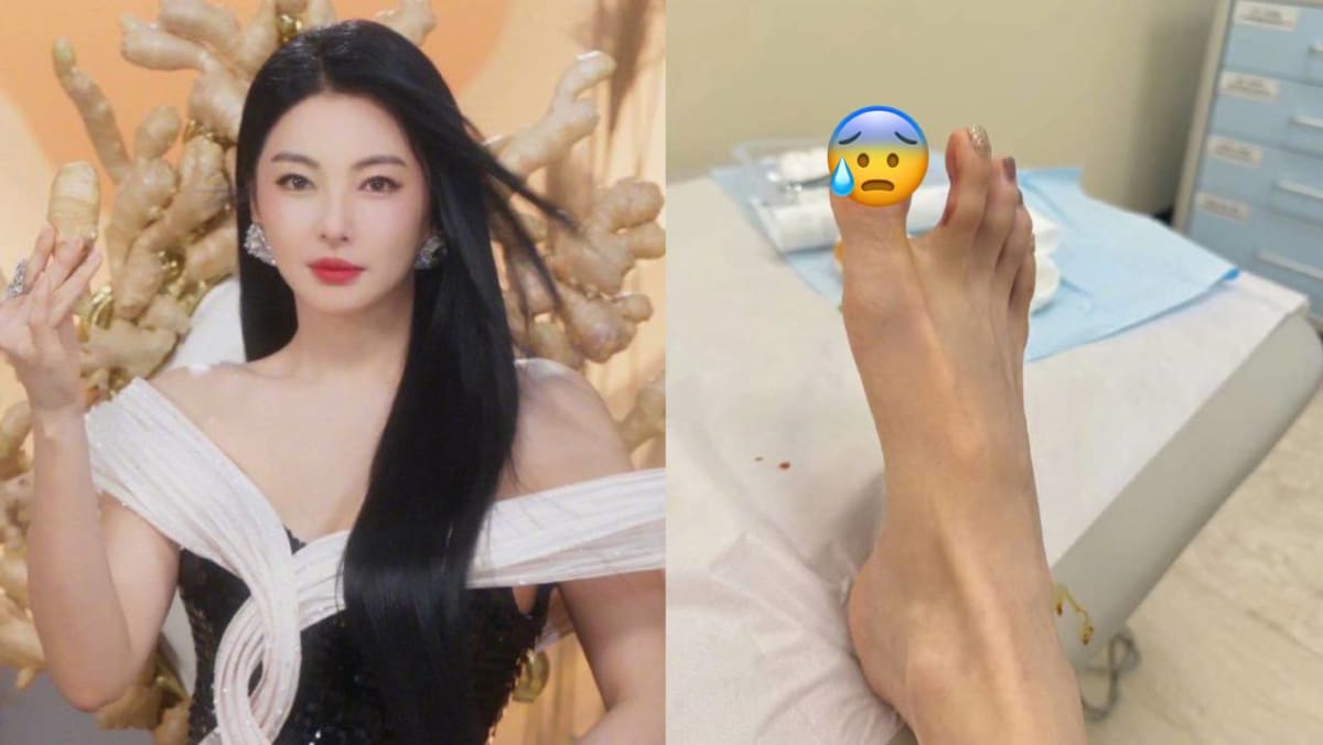 Zhang Yuqi Lost An Entire Toe Nail Due To A Mishap While Wearing Heels