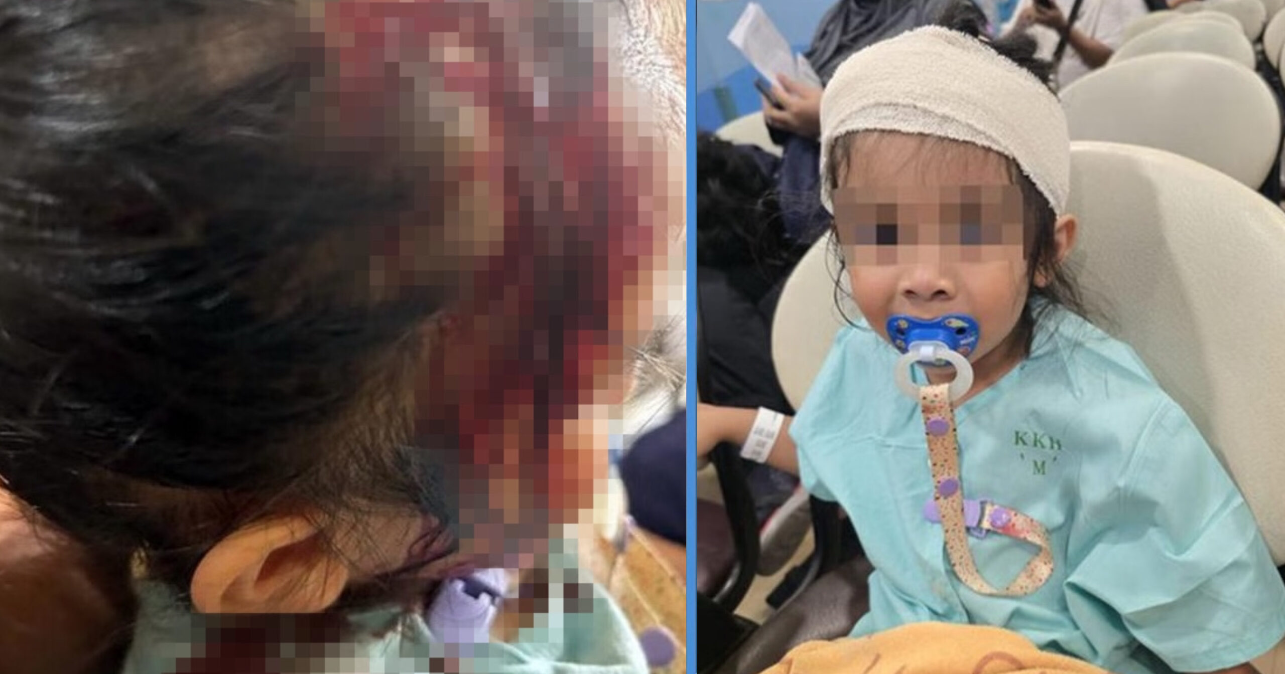 Falling Metal Hook Hit 2-Year-Old Girl in Sengkang Playground, Leading to Deep Gash on Head