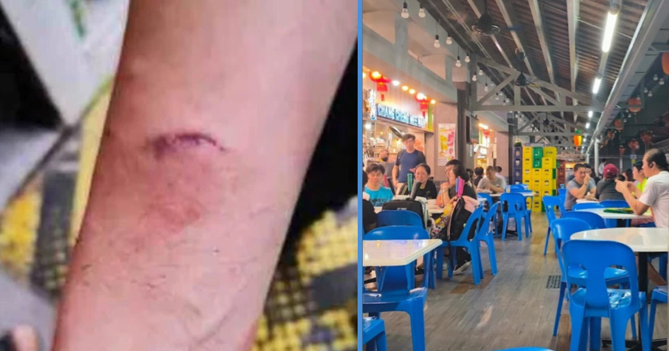 77YO Woman Bites Police Officer After She Was Told to Stop Drinking in a Yishun Coffeeshop